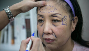 Facing Beauty: China’s plastic surgery addiction