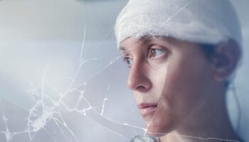 My Brain: After the Rupture