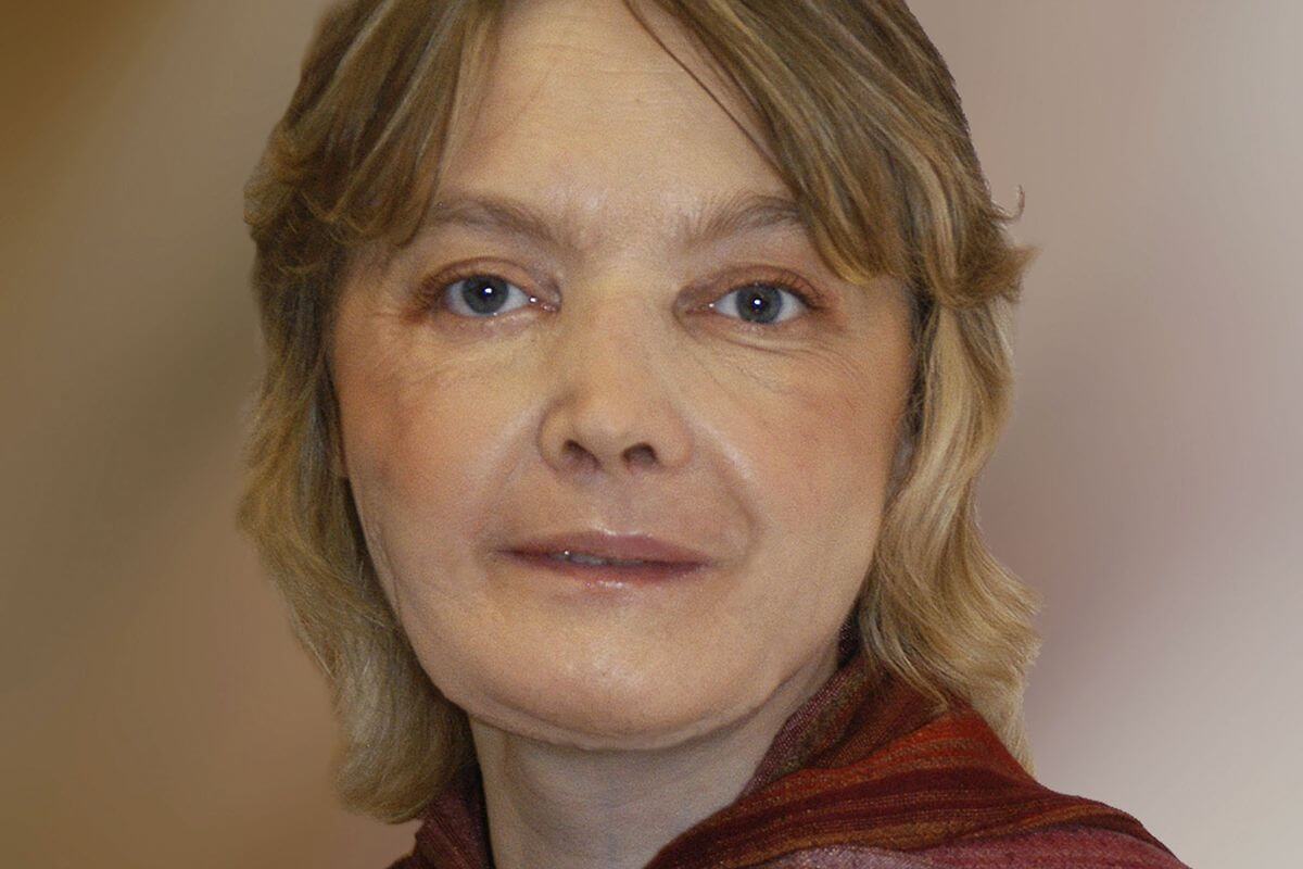 The World’s First Face Transplant